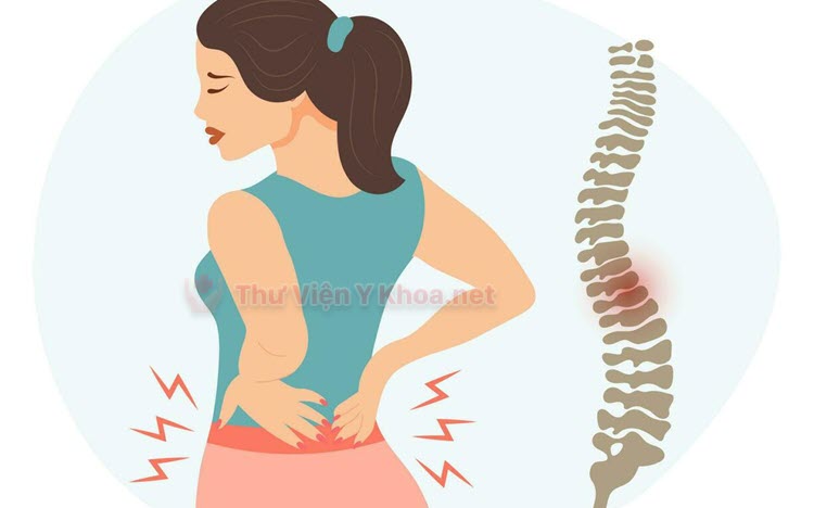 Cách điều trị đau thắt lưng